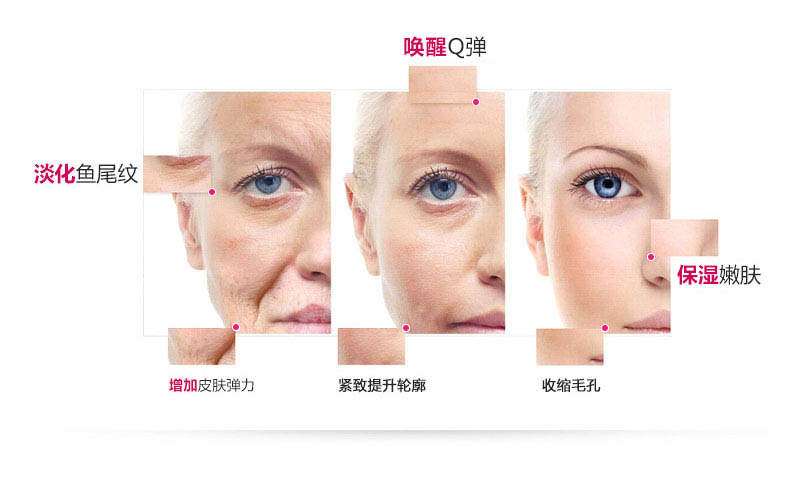 日本娜蜜絲導入美容儀器家用 臉部射頻嫩膚儀童顏機nanoSkin-L