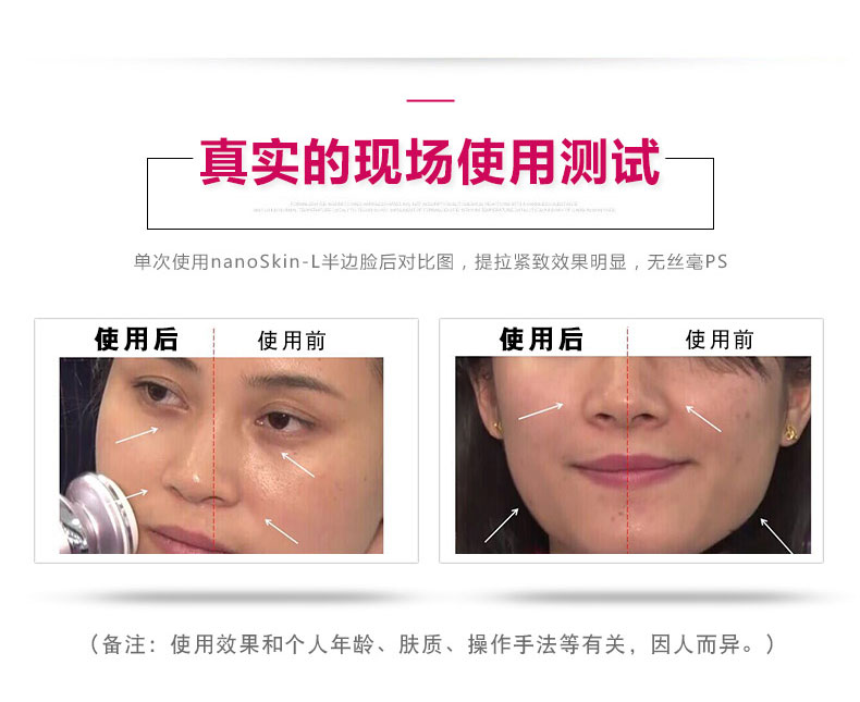 日本娜蜜絲導入美容儀器家用 臉部射頻嫩膚儀童顏機nanoSkin-L